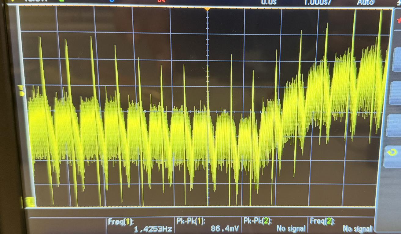 ECG Signal Waveform