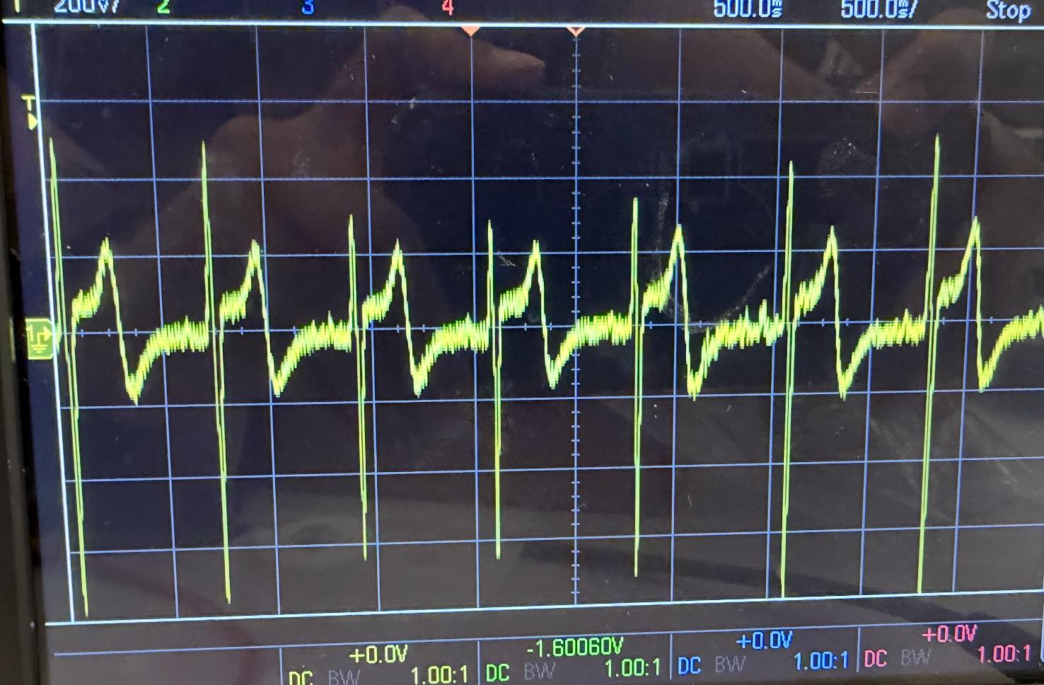 ECG Signal Analysis